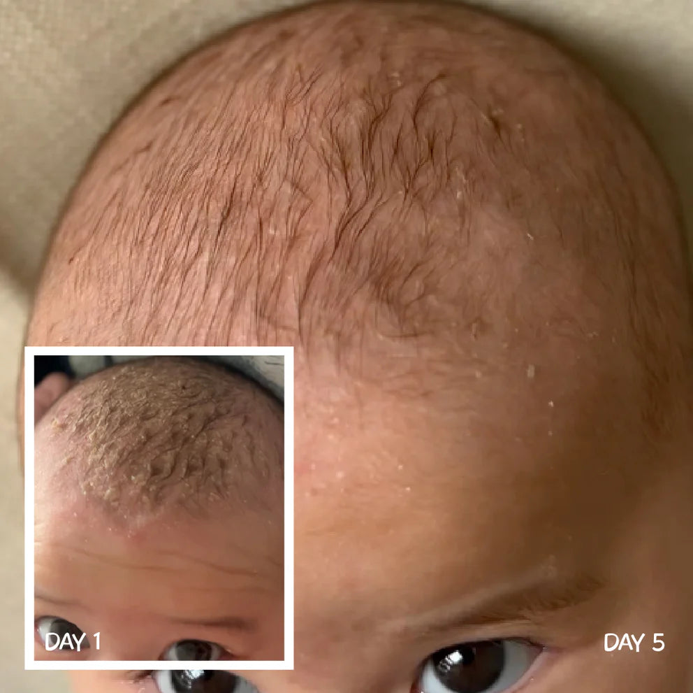 MooGoo Natural Scalp Cream