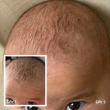 MooGoo Natural Scalp Cream